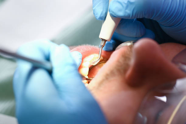 Best Emergency Care for Gum Disease in Red Cloud, NE